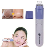 Perfect Pore Cleanser - #1 Solution to Clear Skin