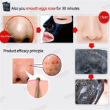 Blackhead Killer - Never Squeeze Blackheads Again