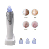 Electronic Blackhead Remover