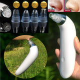 BLACKHEAD ELIMINATOR